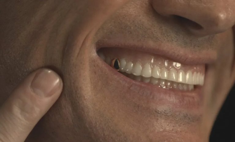 O mistério do dente de ouro de Doctor Who: de quem era essa mão e o que tudo isso significa para a série 14?